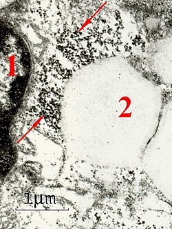 macrophage