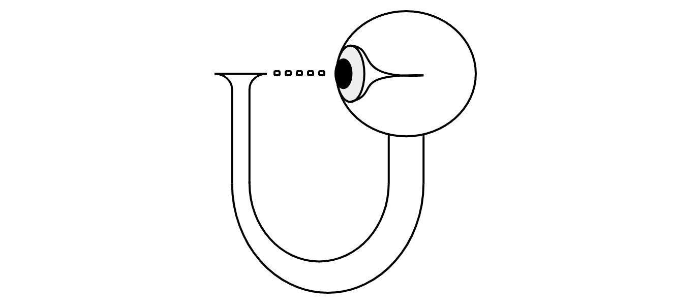 U-Diagram